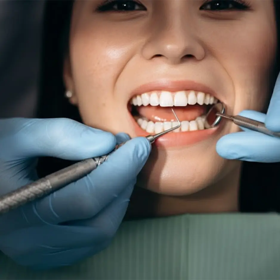 Bleeding Gums Care Laurel