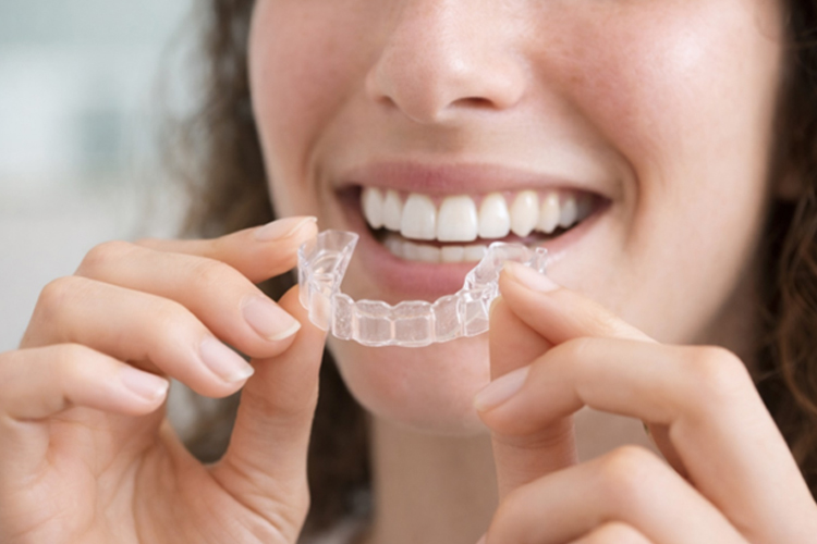 Invisalign Dentist Laurel